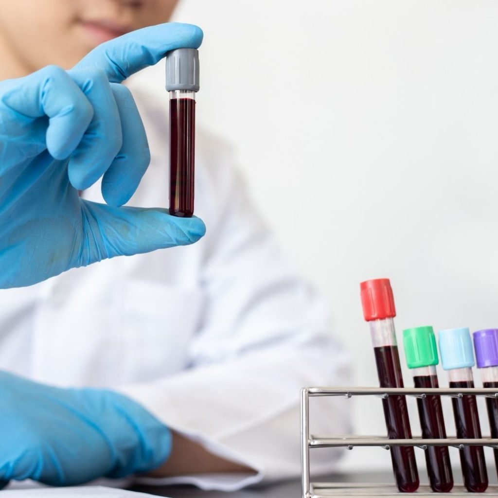 Blue gloved hand with a test tube full of blood in the foreground beside a tray of 4 blood-filled test tubes