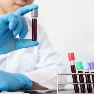 Blue gloved hand with a test tube full of blood in the foreground beside a tray of 4 blood-filled test tubes