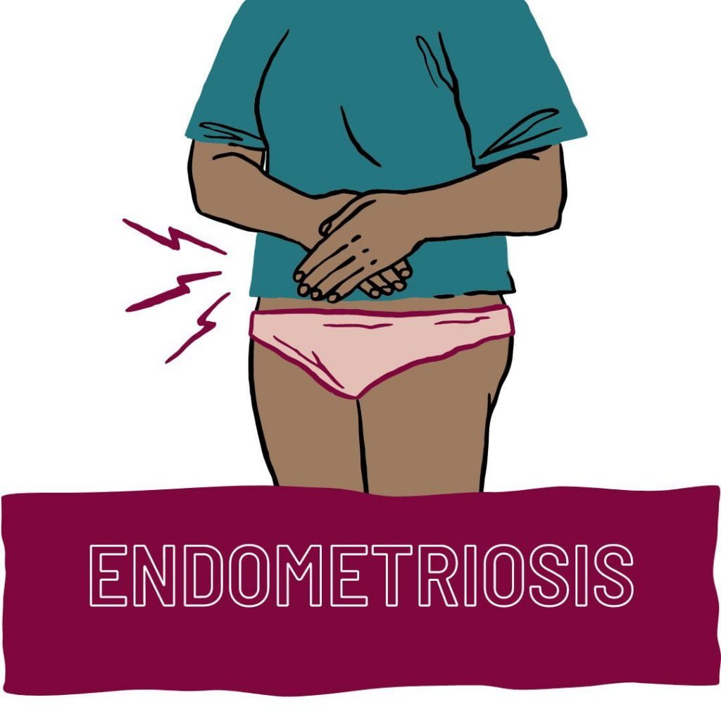brown-skinned person clipart in a teal shirt and pink underwear with hands over the lower abdomen